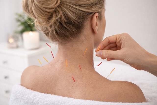 Akupunktur in der Praxis Dr. Anna Tillwich